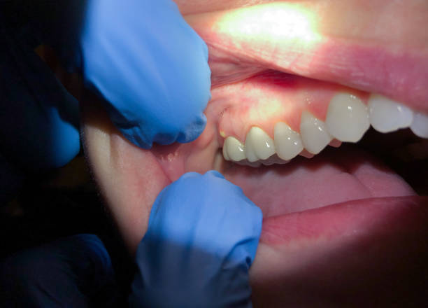 Best Emergency TMJ Treatment in Beacon Square, FL